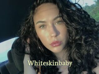 Whiteskinbaby