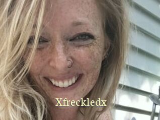Xfreckledx